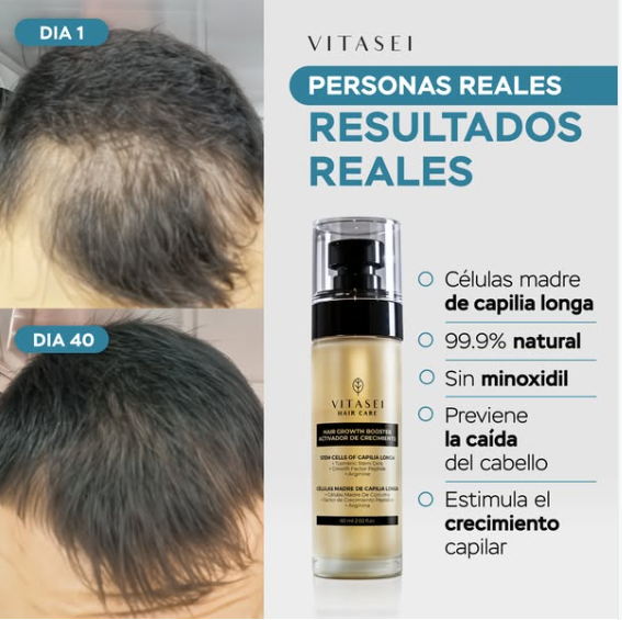 Masajeador de pelo